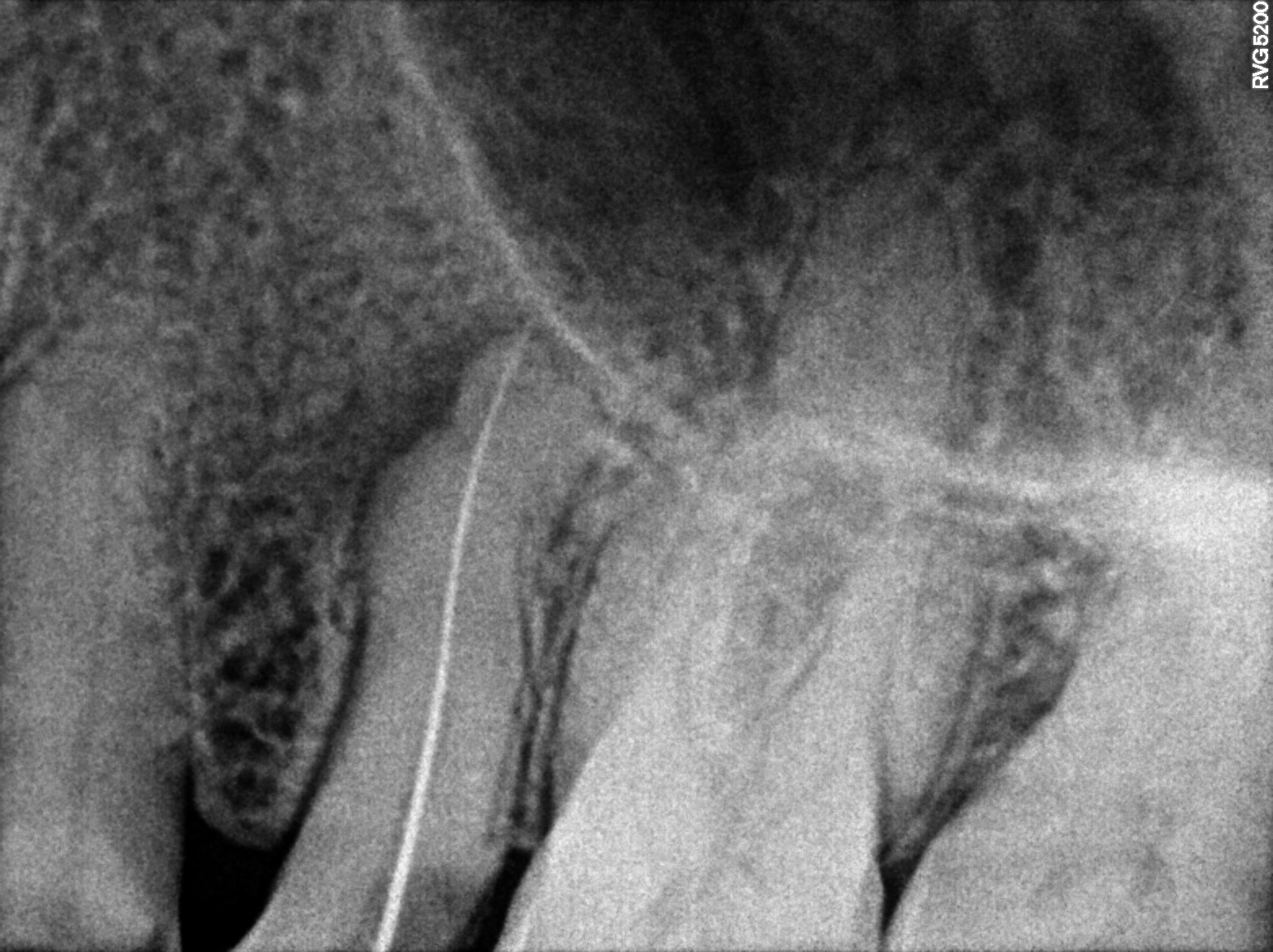 Dental X-ray
